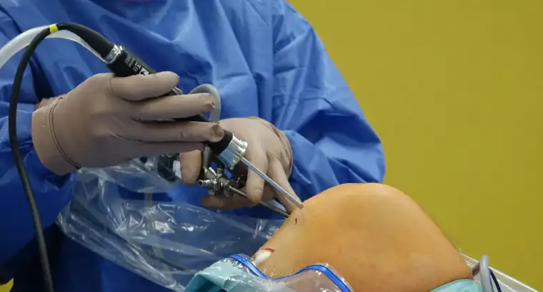 Joint Replacement (Hip, Knee, Shoulder)